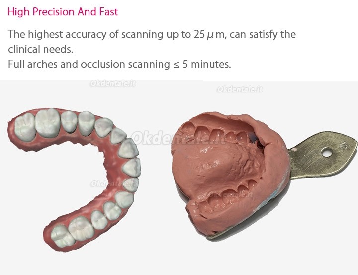 Fussen Scanner Intraorale Digitale 3D Dentale